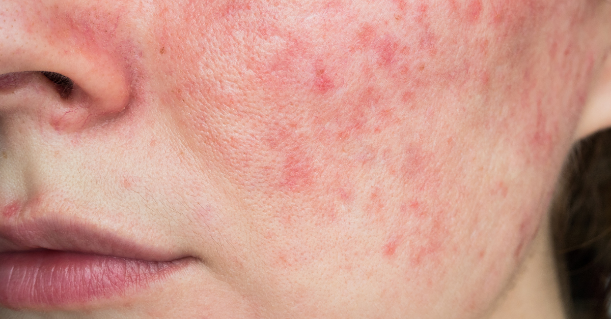 Medico Beauty - Advanced Skincare Experts & UK Cosmedix Distributor