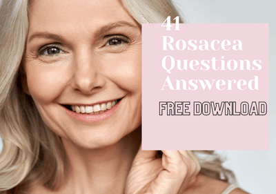 4 Reasons to Love Your Rosacea Cream