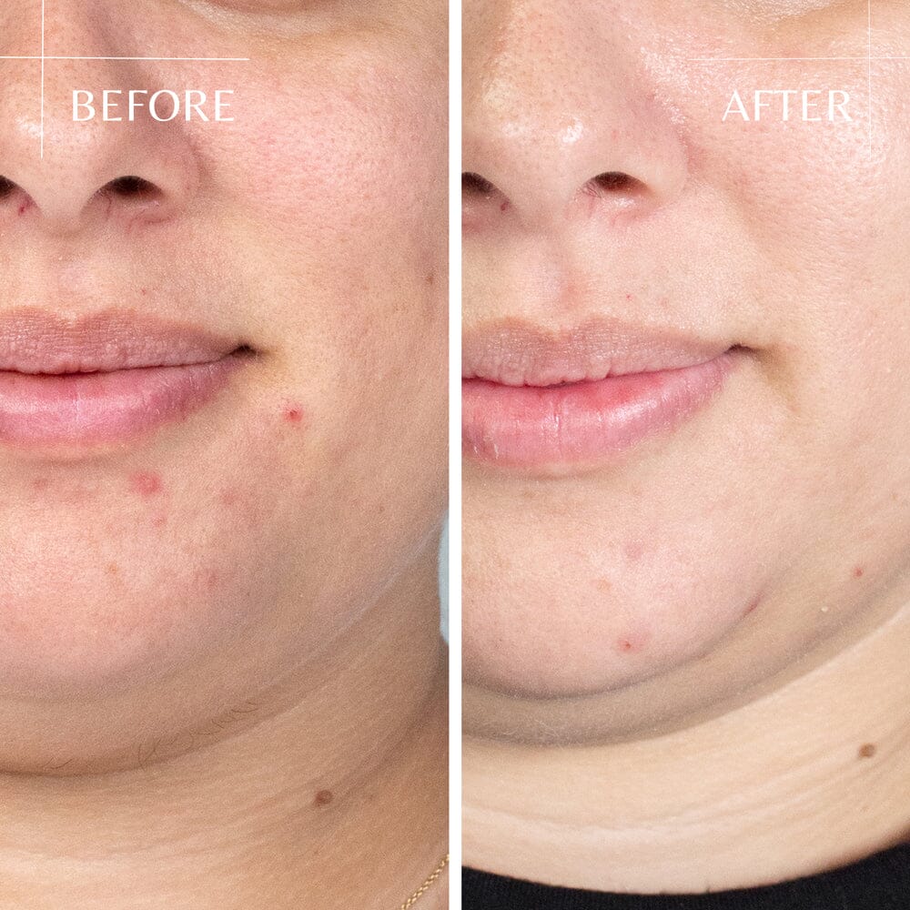 How to Strengthen Your Skin Barrier (And Why It Matters More Than You Think)