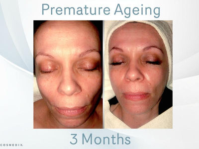 How to Turn Back the Clock on Prematurely Ageing Skin