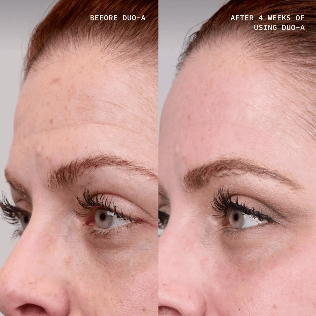 Retinol Not Working? Here's Why (And What To Do Instead)