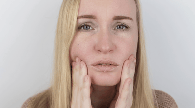 Rosacea triggers: common causes