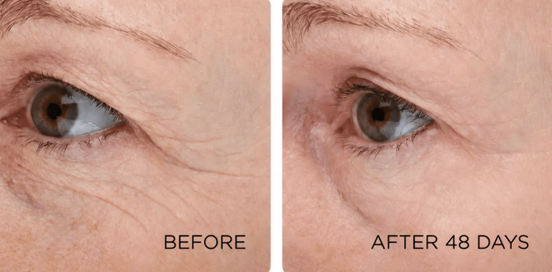 Why Makeup Suddenly Sits in Every Line After 45 — And How to Rebuild the Skin Underneath