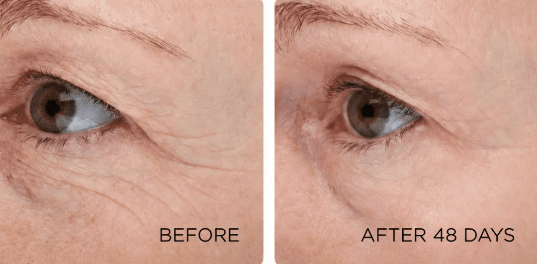 Why Makeup Suddenly Sits in Every Line After 45 — And How to Rebuild the Skin Underneath