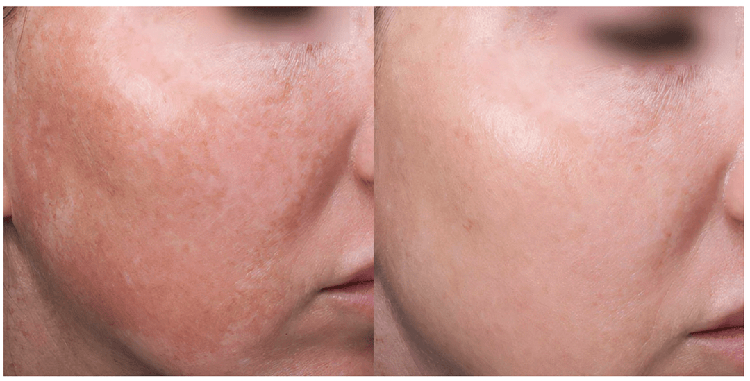 Why Most Skincare Routines Fail (And How to Fix Yours for Long-Term Results)