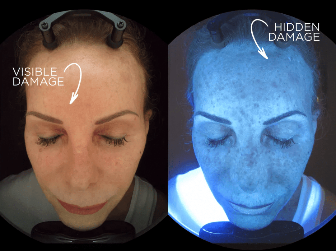 Why Skin Can Feel Oily and Dry at the Same Time — And What to Do About It