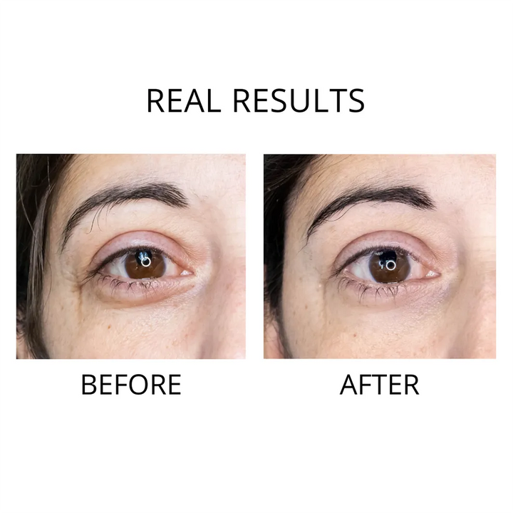 I-Complex Daytime Eye Treatment 10 ml/ 0.34 fl oz - CosMedix Elite Stimulate & Renew Cosmedix Elite 