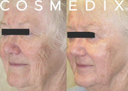 CosMedix Benefit Peel Treatment Menu Professional Cosmedix 