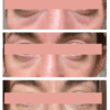Eye 1 ml Foil Sample - AnteAGE MD® Stimulate & Renew AnteAGE® MD 
