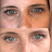 Eye 15 ml - AnteAGE® Stimulate & Renew AnteAGE® MD 