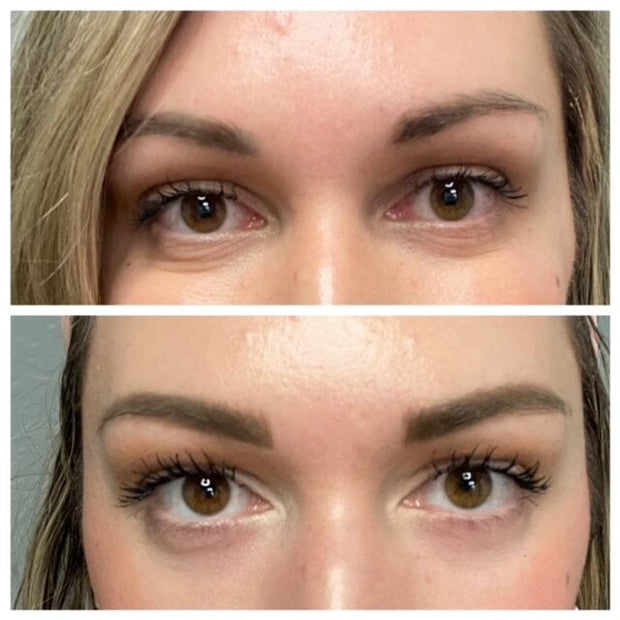 Eye 15 ml - AnteAGE® Stimulate & Renew AnteAGE® MD 
