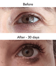 Lash Growth Serum (Length & Volume) 3.5ml - AnteAGE® MD Stimulate & Renew AnteAGE® MD 